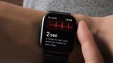 Apple Watch e Fibrillazione Atriale: l'azienda citata in giudizio da un medico americano