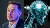 Elon Musk sperimenterà i primi chip nel cervello umano entro il 2021! Ecco la conferma